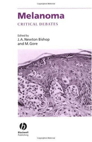 melanoma: critical debates