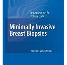 minimally invasive breast biopsies