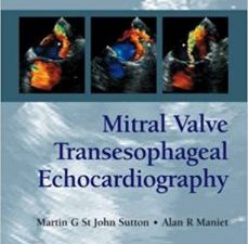 mitral valve transesophageal echocardiography