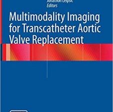 multimodality imaging for transcatheter aortic valve replacement