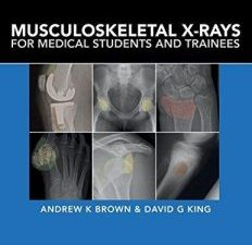 musculoskeletal x rays for medical students and trainees