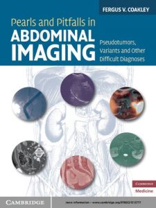 pearls and pitfalls in abdominal imaging: pseudotumors, variants and other difficult diagnoses