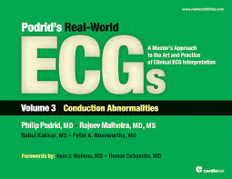 podrid’s real world ecgs: volume 3, conduction abnormalities