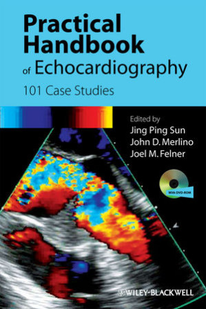 practical handbook of echocardiography: 101 case studies