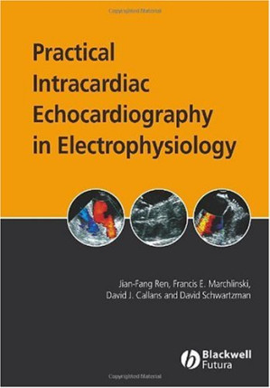 practical intracardiac echocardiography in electrophysiology