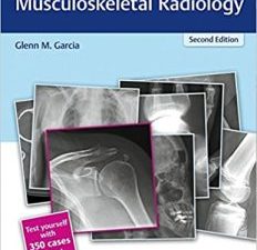 radcases q&a musculoskeletal radiology (radcases plus q&a) 2nd edition
