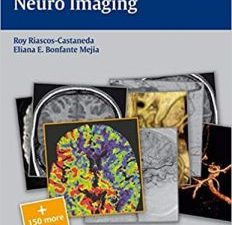 radcases neuro imaging (radcases plus q&a) 1st edition