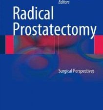 radical prostatectomy: surgical perspectives
