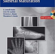 radiographic atlas of skeletal maturation 1st edition