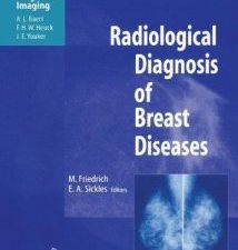 radiological diagnosis of breast diseases