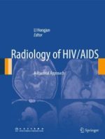 radiology of hiv/aids: a practical approach