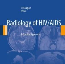 radiology of hiv/aids: a practical approach