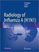radiology of influenza a