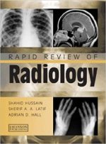 rapid review of radiology (medical rapid review series) 1st edition
