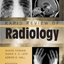 rapid review of radiology (medical rapid review series) 1st edition