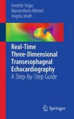real time three dimensional transesophageal echocardiography: a step by step guide