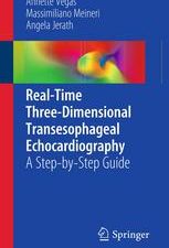 real time three dimensional transesophageal echocardiography: a step by step guide