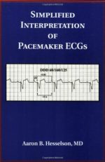 simplified interpretation of pacemaker ecgs: an introduction