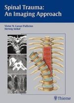 spinal trauma – an imaging approach