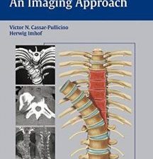 spinal trauma – an imaging approach