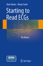 starting to read ecgs: the basics (2014)