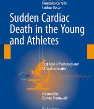 sudden cardiac death in the young and athletes