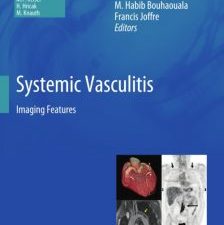 systemic vasculitis: imaging features