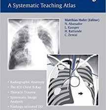 the chest x ray: a systematic teaching atlas 1st edition