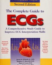 the complete guide to ecgs