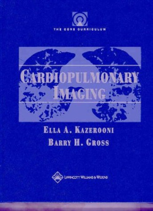 the core curriculum: cardiopulmonary imaging