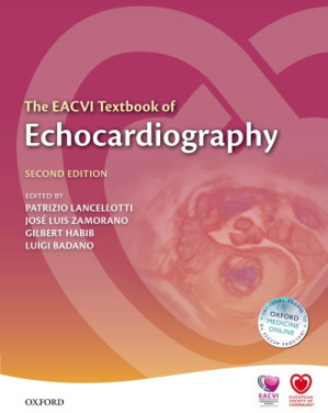 the eacvi textbook of echocardiography (2nd edition)