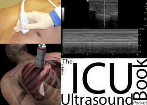 the icu ultrasound pocket book