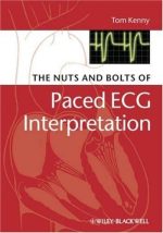 the nuts and bolts of paced ecg interpretation