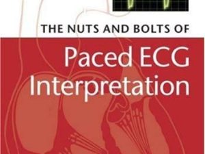the nuts and bolts of paced ecg interpretation