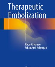 therapeutic embolization