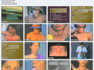videos of clinical examination in surgery