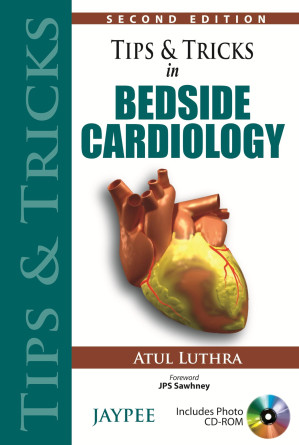 tips and tricks of bedside cardiology – 2nd edition (2013)