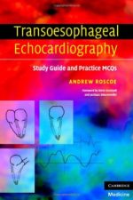 transoesophageal echocardiography: study guide and practice mcqs