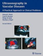ultrasonography in vascular diseases: a practical approach to clinical problems, 2nd edition