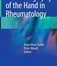 ultrasonography of the hand in rheumatology
