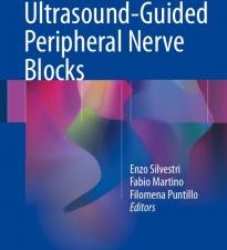 ultrasound guided peripheral nerve blocks