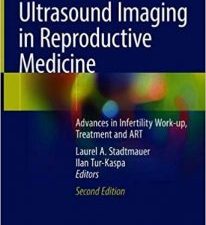 ultrasound imaging in reproductive medicine: advances in infertility work up, treatment and art edition 2