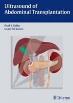 ultrasound of abdominal transplantation