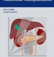 ultrasound of abdominal transplantation