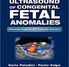 ultrasound of congenital fetal anomalies: differential diagnosis and prognostic indicators, second edition