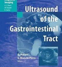 ultrasound of the gastrointestinal tract (medical radiology diagnostic imaging)