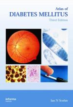 atlas of diabetes mellitus, third edition
