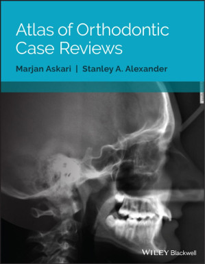 atlas of orthodontic case reviews