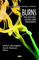 burns: prevention, causes & treatment