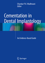 cementation in dental implantology: an evidence based guide (2015)